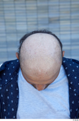 Head Man White Casual Chubby Bald Street photo references
